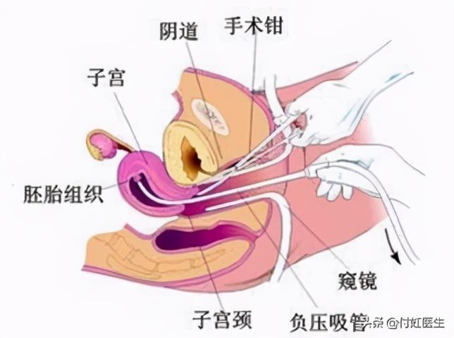 第1642页